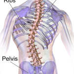 Blausen_0785_Scoliosis_01